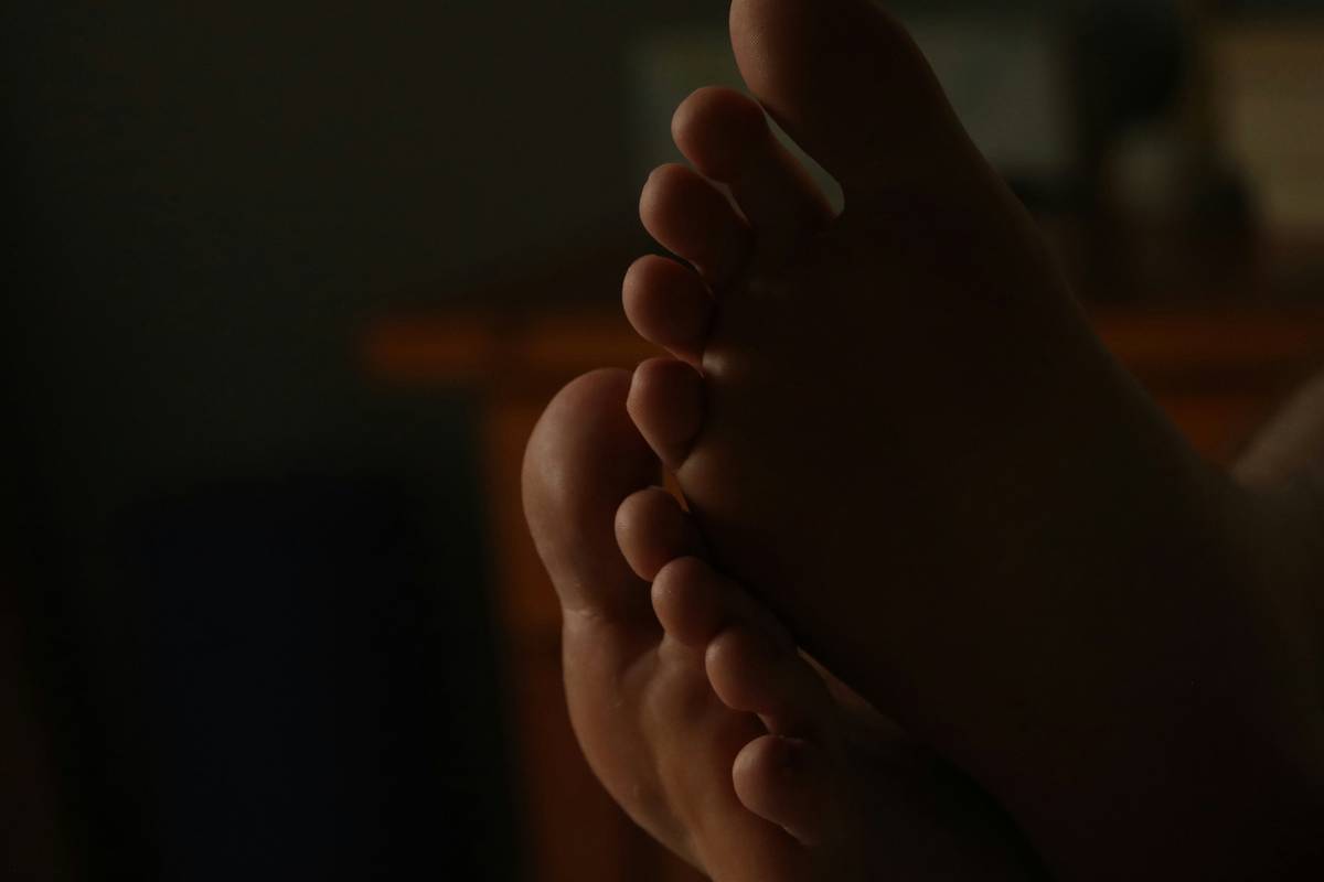Before and after results using skincare essential foot mask a good formula with urea