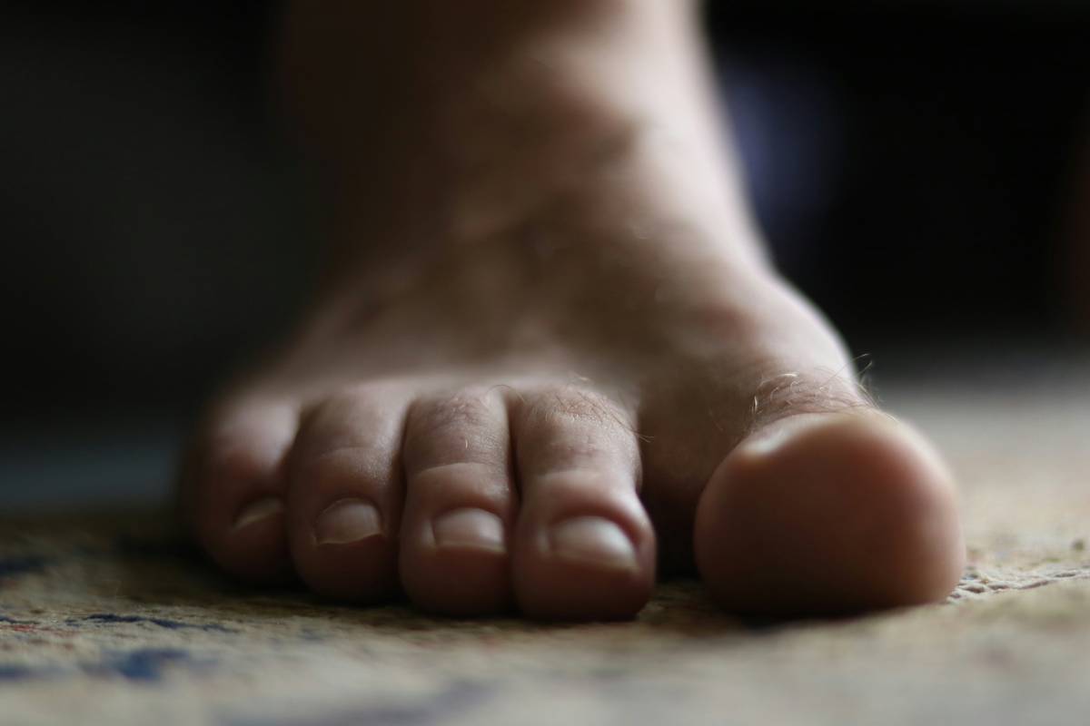 cms routine foot care: The Overlooked Ritual That Transforms Dry, Cracked Feet